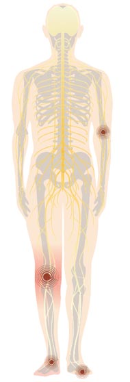 Augmentin vs amoxicillin